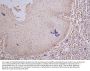 MKI67 Recombinant Monoclonal Antibody