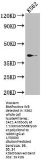 SAE1 Recombinant Monoclonal Antibody