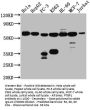 PTBP1 Recombinant Monoclonal Antibody