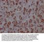 PTBP1 Recombinant Monoclonal Antibody