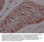 PTBP1 Recombinant Monoclonal Antibody