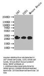 BDNF Recombinant Monoclonal Antibody