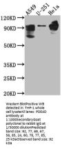 PDE4D Recombinant Monoclonal Antibody