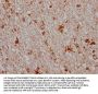 MAOB Recombinant Monoclonal Antibody