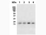 Anti-Mouse IFN Gamma (H22) In Vivo Antibody - Low Endotoxin