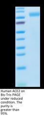 Human ACE2/ACEH Protein (ACE-HM101)