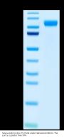 Mouse ACE2/ACEH Protein (ACE-MM102)