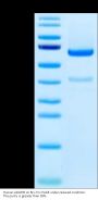 Human ADAM9 Protein (ADM-HM109)