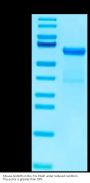 Mouse ADAM8 Protein (ADM-MM108)