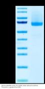Mouse ADAM9 Protein (ADM-MM109)