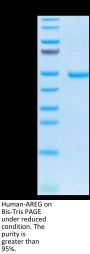 Human AREG Protein (AEG-HM201)