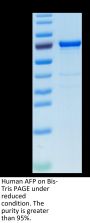 Human AFP Protein (AFP-HM101)
