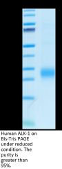 Human ALK-1/ACVRL1 Protein (ALK-HM101)
