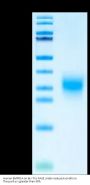 Human BMPR1A/ALK-3 Protein (ALK-HM103)