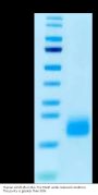 Human ACVR1B/Activin RIB Protein (ALK-HM104)