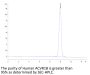 Human ACVR1B/Activin RIB Protein (ALK-HM104)