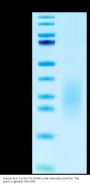 Human ALK-7/Activin RIC Protein (ALK-HM107)