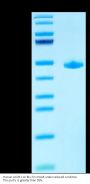 Human ACVR1/Activin RI Protein (ALK-HM202)