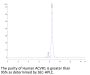 Human ACVR1/Activin RI Protein (ALK-HM202)