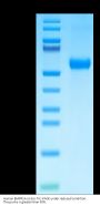 Human BMPR1A/ALK-3 Protein (ALK-HM203)