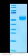 Human ALK-7/Activin RIC Protein (ALK-HM207)