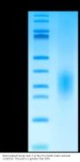 Biotinylated Human ALK-7/Activin RIC Protein (ALK-HM407B)