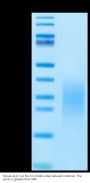 Mouse ALK-7/Activin RIC Protein (ALK-MM107)