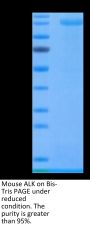 Mouse ALK Protein (ALK-MM201)