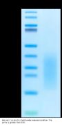 Rat ALK-7/Activin RIC Protein (ALK-RM107)