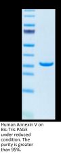 Human Annexin V/ANXA5 Protein (AN5-HE005)
