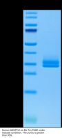 Human ANGPTL2/Angiopoietin-like 2 Protein (ANG-HM4L2)