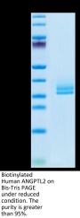 Biotinylated Human ANGPTL2/Angiopoietin-like 2 Protein (ANG-HM4L2B)