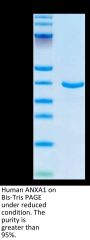 Human ANXA1 Protein (ANX-HE1A1)
