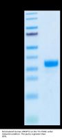 Biotinylated Human ANGPT2/Angiopoietin-2 Protein (APN-HM401B)