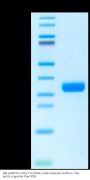 Rat ANGPT2/Angiopoietin-2 Protein (APN-RM102)