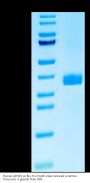 Human APOE2/Apolipoprotein E Protein (APO-HM1E2)