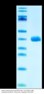 Biotinylated Human APOE3/Apolipoprotein E Protein (APO-HM403B)
