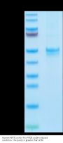 Human ARTN Protein (ARN-HM201)