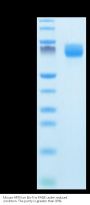 Mouse ARTN Protein (ARN-MM201)