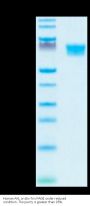 Human AXL Protein (AXL-HM401)