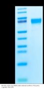 Rat AXL Protein (AXL-RM101)