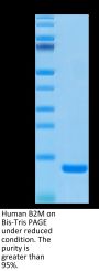 Human B2M/beta 2-Microglobulin Protein (B2M-HM101)