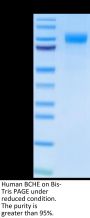 Human BCHE/Butyrylcholinesterase Protein (BCE-HM101)