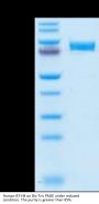 Human B7-H4 Protein (BH7-HM274)