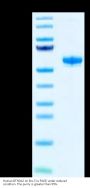 Human BTN3A2 Protein (BNT-HM2A2)