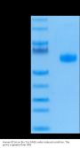 Human BTLA Protein (BTL-HM201)