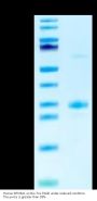 Human BTN3A1/CD277 Protein (BTN-HM0A1)