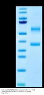 Human BTN2A1&BTN3A1 complex Protein (BTN-HM123)