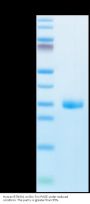 Human BTN3A1/CD277 Protein (BTN-HM1A1)
