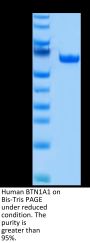 Human BTN1A1/Butyrophilin Protein (BTN-HM2A1)